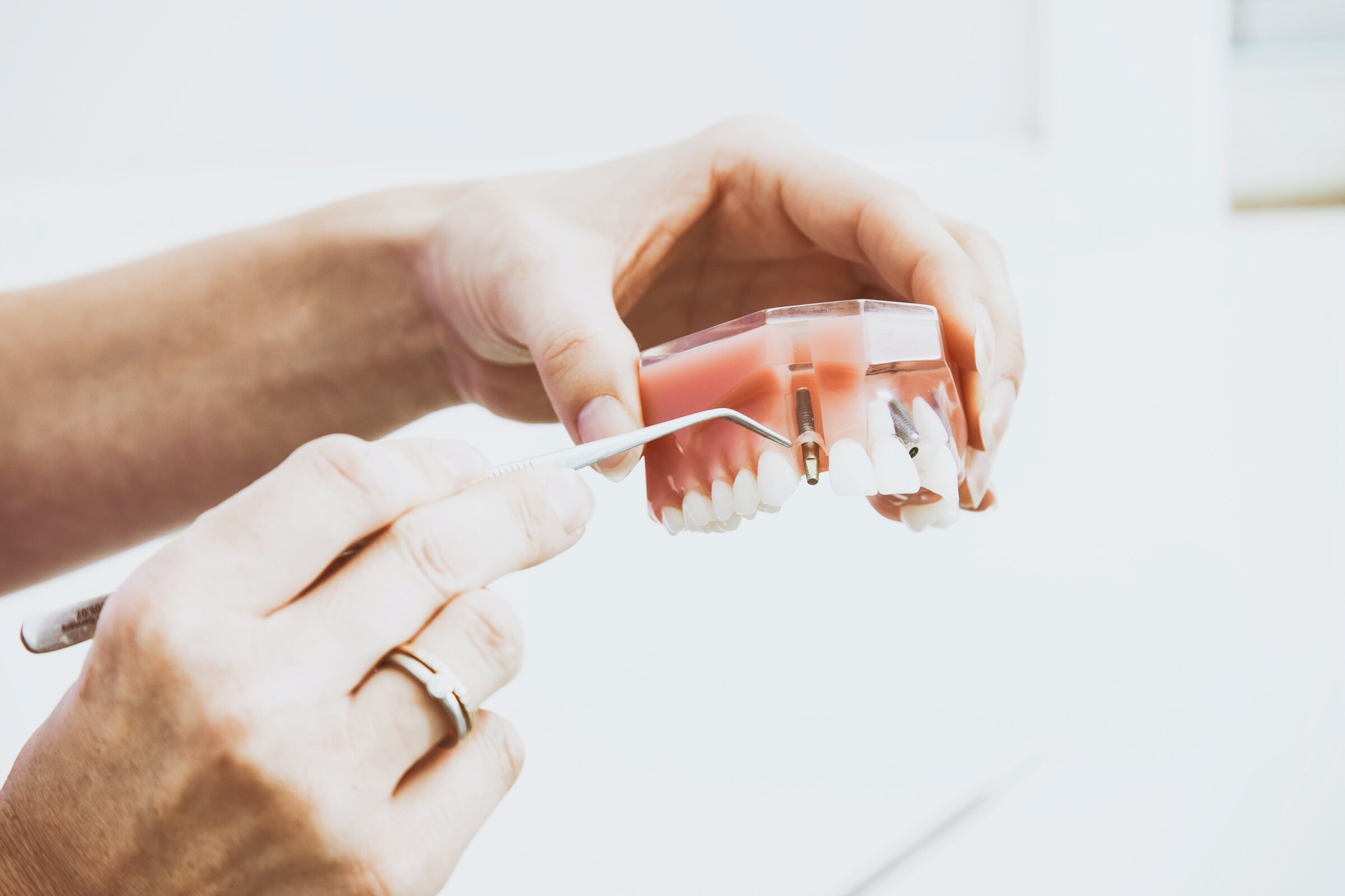 Reparatie kunstgebit Dental Dokkum